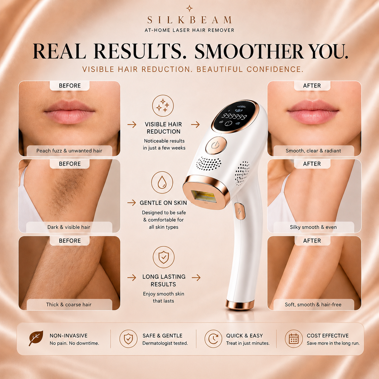 SilkBeam - Laser Hair Removal